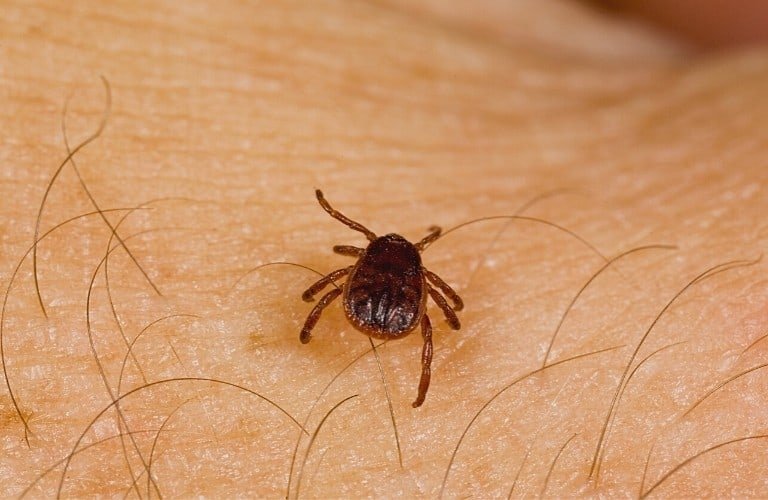 A tick crawling in the crook of a man's arm.